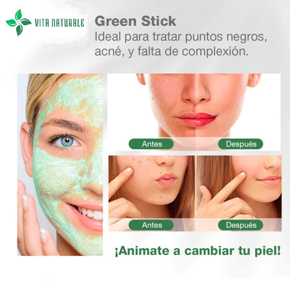 2X Mascarilla Té erde para Acné y puntos negros + PRODUCTO DE REGALO 🎁 + EBOOK